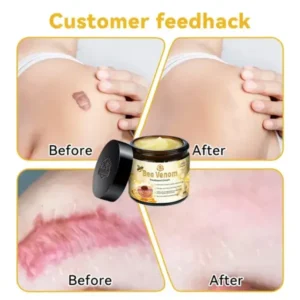 Turonu™ Bee Venom Therapy Cream