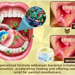 𝐎𝐲𝐢𝐤𝐞𝐲™ Focussmile Bee Venom Treatment Oral Powder